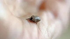 Kliešť na koži: ako postupovať a kam sa obrátiť po uštipnutí