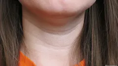 Okamžite prezradí vek: ako sa zbaviť Venušiných krúžkov na krku